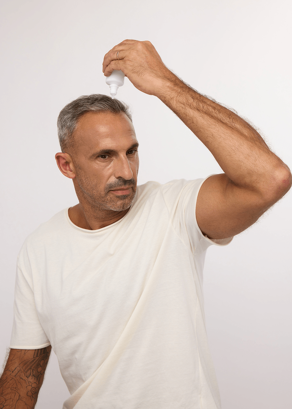 טיפול בהתקרחות גברית